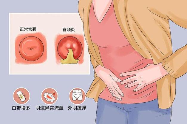尿路感染和阴道炎怎么区分