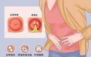 尿频尿痛是尿路感染还是阴道炎-两性知识丨两性健康--你想了解的我都知道