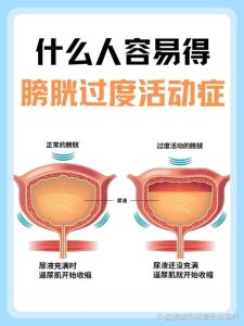 性欲低和膀胱过度活动有关吗？-两性知识丨两性健康--你想了解的我都知道